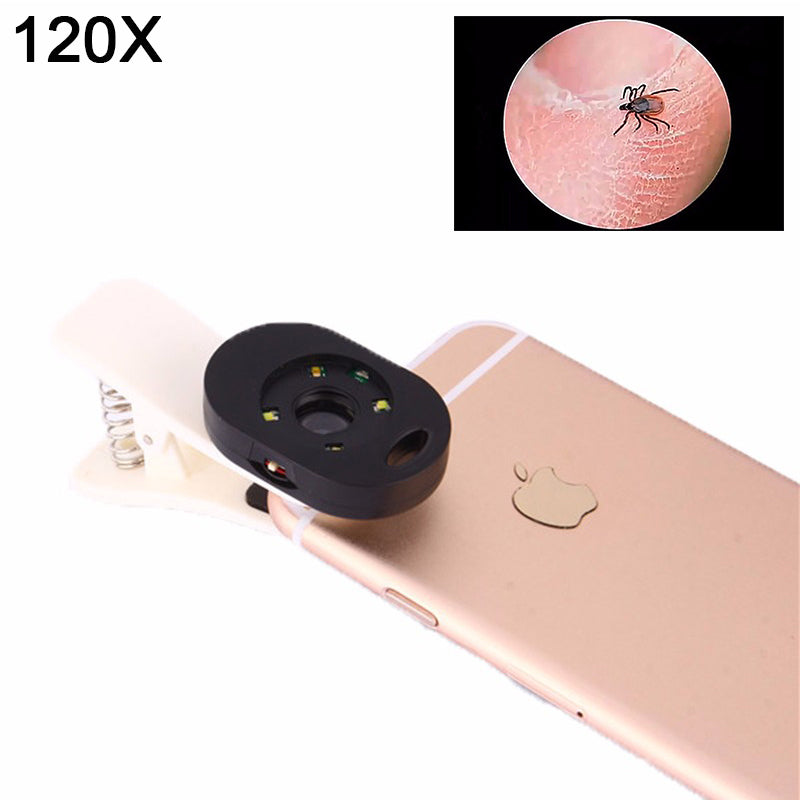 2017 120x macro lens with LED light Camera Mobile Phone lenses macro lentes For Xiaomi redmi 4 4X note4 MI5 MI5S  MI6 NOTE2 MIX